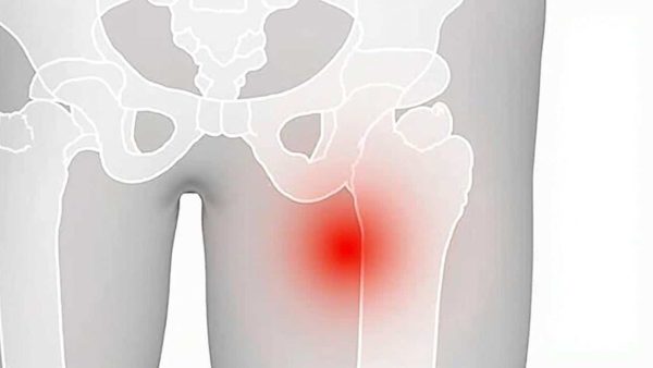 The Shocking Truth About the Limits of Exercise for Osteoarthritis Relief
